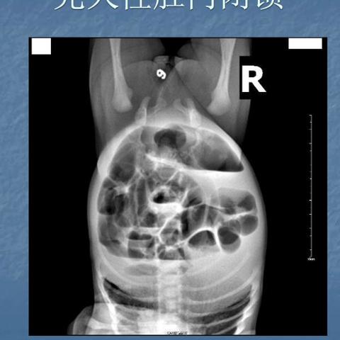 检验危急值的最新标准解读