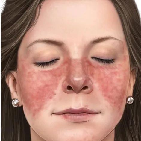 最新精神分裂疗法，重塑生活质量的希望之路